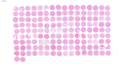 组织芯片扫描(白光)(图1) 组织芯片扫描(白光)(图1)