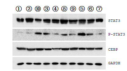 蛋白质免疫检测(图1) 提供Western blot 检测服务(6~8个样)(图1)