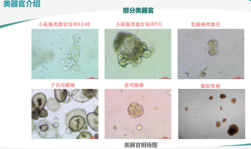 胃癌类器官培养基(JFKR-CRC-100/JFKR-CRC-500)(图2)