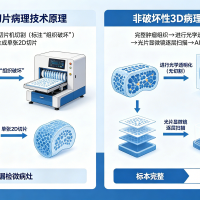 <strong>非破坏性3D病理技术：肿瘤诊断与精准医疗的新前沿数字病理技术</strong>